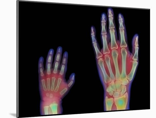 Adult And Child Hand X-rays-Science Photo Library-Mounted Photographic Print