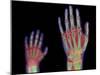 Adult And Child Hand X-rays-Science Photo Library-Mounted Photographic Print
