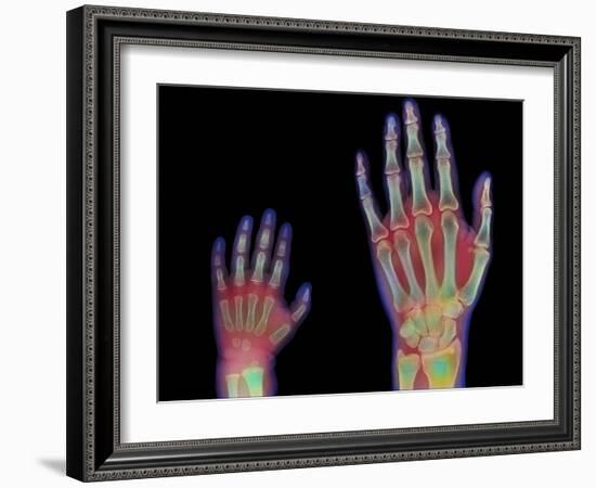 Adult And Child Hand X-rays-Science Photo Library-Framed Photographic Print