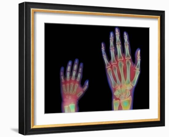 Adult And Child Hand X-rays-Science Photo Library-Framed Photographic Print