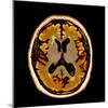 Alcoholic Dementia, MRI Scan-Du Cane Medical-Mounted Premium Photographic Print
