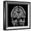 Alcoholic Dementia, MRI Scan-Du Cane Medical-Framed Photographic Print
