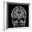 Alcoholic Dementia, MRI Scan-Du Cane Medical-Framed Photographic Print