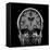Alcoholic Dementia, MRI Scan-Du Cane Medical-Framed Premier Image Canvas