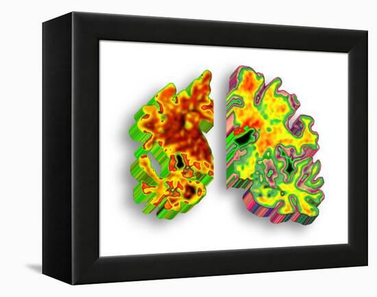 Alzheimer's Disease, Artwork-PASIEKA-Framed Premier Image Canvas