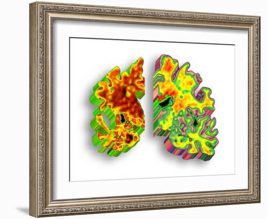 Alzheimer's Disease, Artwork-PASIEKA-Framed Photographic Print