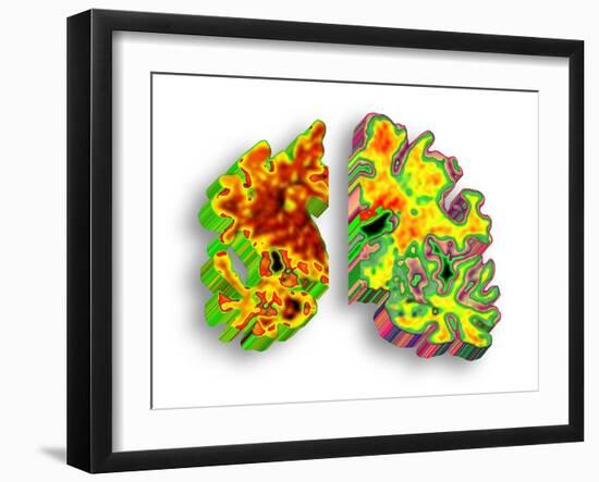 Alzheimer's Disease, Artwork-PASIEKA-Framed Photographic Print