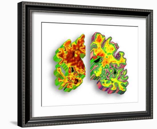 Alzheimer's Disease, Artwork-PASIEKA-Framed Photographic Print