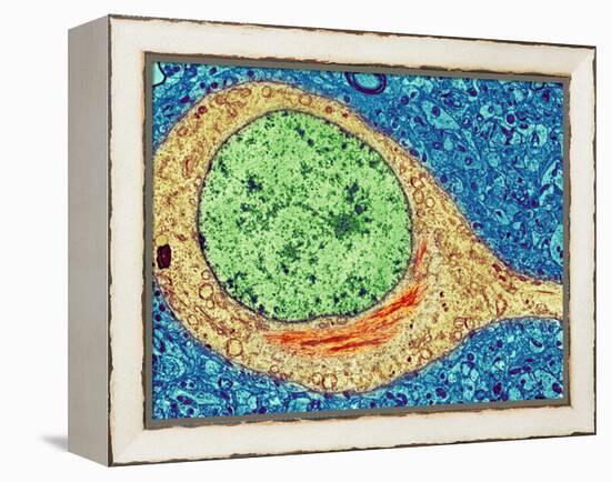 Alzheimer's Disease Brain Cell, TEM-Thomas Deerinck-Framed Premier Image Canvas