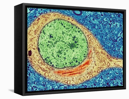 Alzheimer's Disease Brain Cell, TEM-Thomas Deerinck-Framed Premier Image Canvas