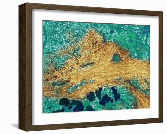 Alzheimer's Disease Brain Cell, TEM-Thomas Deerinck-Framed Photographic Print