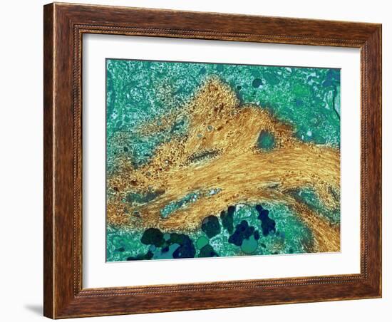 Alzheimer's Disease Brain Cell, TEM-Thomas Deerinck-Framed Photographic Print