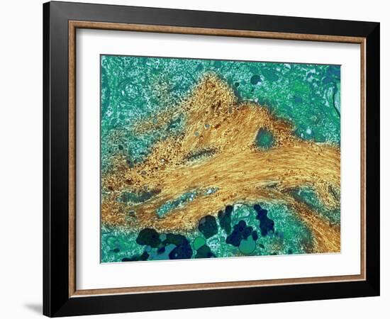 Alzheimer's Disease Brain Cell, TEM-Thomas Deerinck-Framed Photographic Print