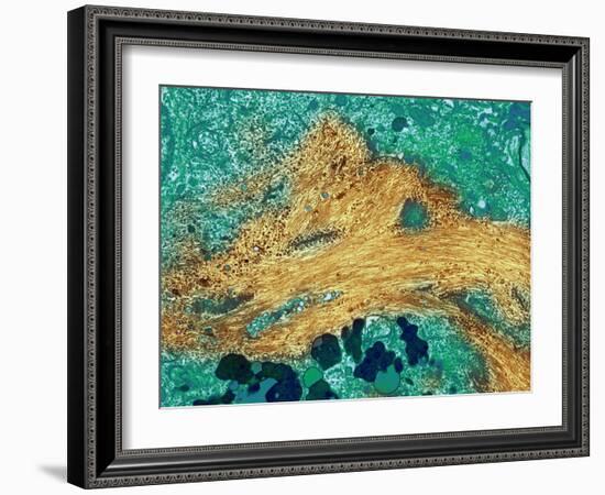 Alzheimer's Disease Brain Cell, TEM-Thomas Deerinck-Framed Photographic Print