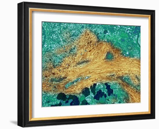 Alzheimer's Disease Brain Cell, TEM-Thomas Deerinck-Framed Photographic Print