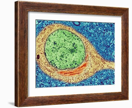 Alzheimer's Disease Brain Cell, TEM-Thomas Deerinck-Framed Photographic Print