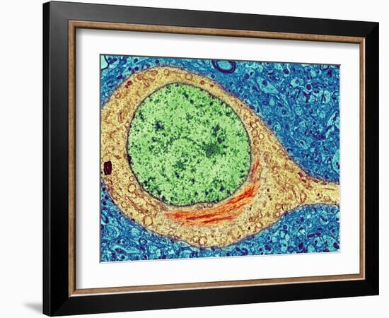 Alzheimer's Disease Brain Cell, TEM-Thomas Deerinck-Framed Photographic Print