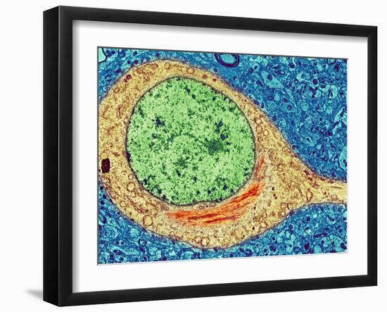 Alzheimer's Disease Brain Cell, TEM-Thomas Deerinck-Framed Photographic Print