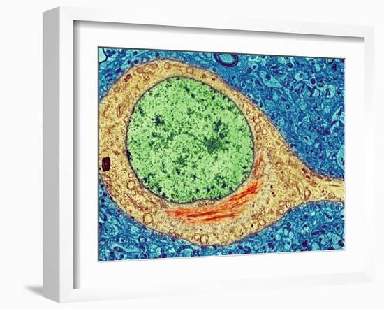 Alzheimer's Disease Brain Cell, TEM-Thomas Deerinck-Framed Photographic Print