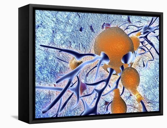Alzheimer's Disease, Computer Artwork-PASIEKA-Framed Premier Image Canvas