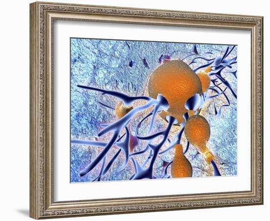 Alzheimer's Disease, Computer Artwork-PASIEKA-Framed Photographic Print