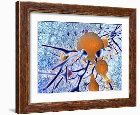 Alzheimer's Disease, Computer Artwork-PASIEKA-Framed Photographic Print