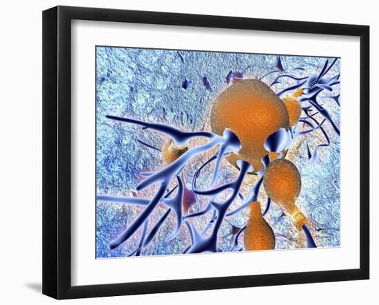 Alzheimer's Disease, Computer Artwork-PASIEKA-Framed Photographic Print