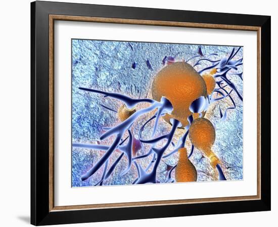 Alzheimer's Disease, Computer Artwork-PASIEKA-Framed Photographic Print