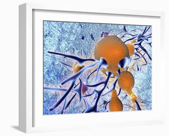 Alzheimer's Disease, Computer Artwork-PASIEKA-Framed Photographic Print