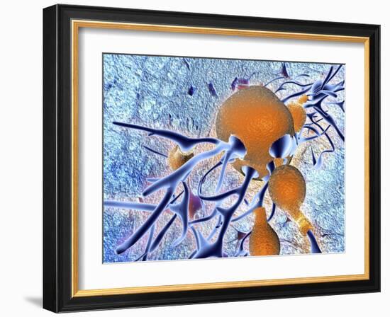 Alzheimer's Disease, Computer Artwork-PASIEKA-Framed Photographic Print