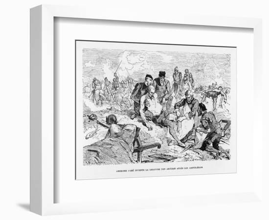 Ambroise Pare French Surgeon Invented the Procedure of Sewing up Arteries after Amputation-Figuier-Framed Art Print