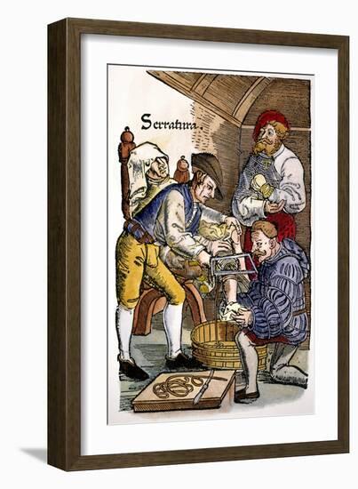 Amputation, 1540-Hans von Gersdorff-Framed Giclee Print