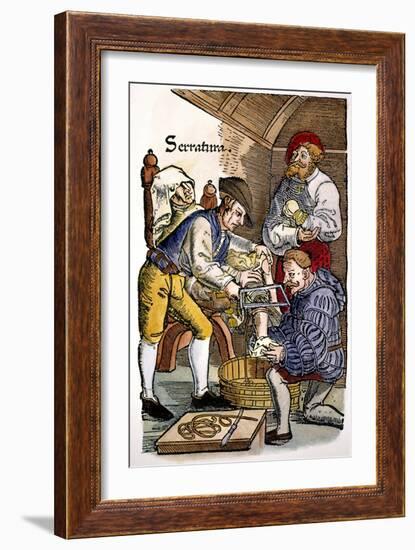 Amputation, 1540-Hans von Gersdorff-Framed Giclee Print