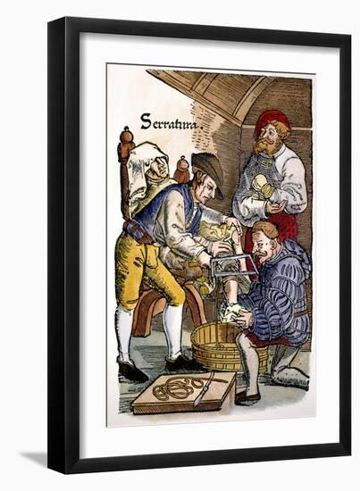Amputation, 1540-Hans von Gersdorff-Framed Giclee Print