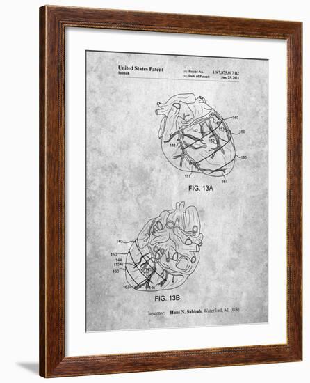 Anatomical Heart-Cole Borders-Framed Art Print