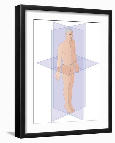 Anatomical Planes of the Body, Artwork-Peter Gardiner-Framed Photographic Print