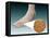 Anatomy of Foot Fungus with Microscopic Close-Up-null-Framed Stretched Canvas