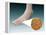 Anatomy of Foot Fungus with Microscopic Close-Up-null-Framed Stretched Canvas