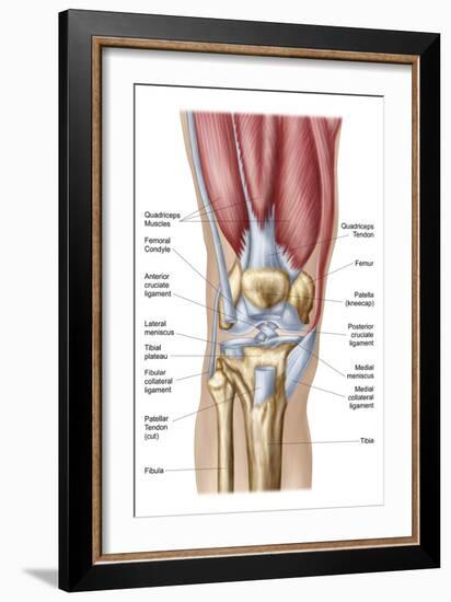 Anatomy of Human Knee Joint-null-Framed Art Print