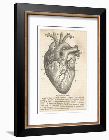 Anatomy of the Heart-null-Framed Photographic Print