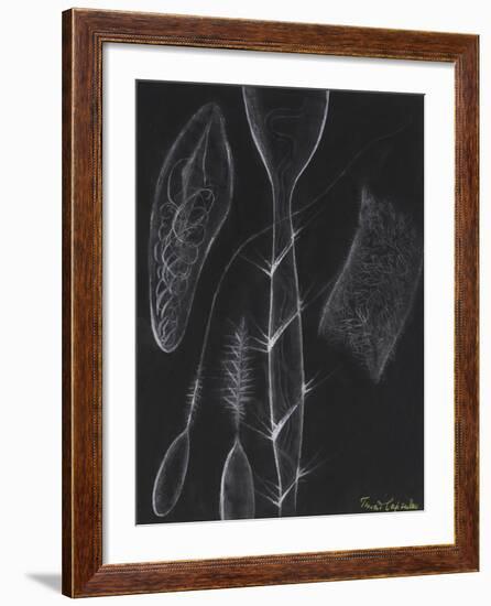 Anemone Stinging Cells-Philip Henry Gosse-Framed Giclee Print