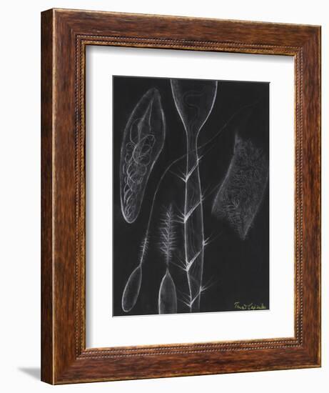 Anemone Stinging Cells-Philip Henry Gosse-Framed Giclee Print