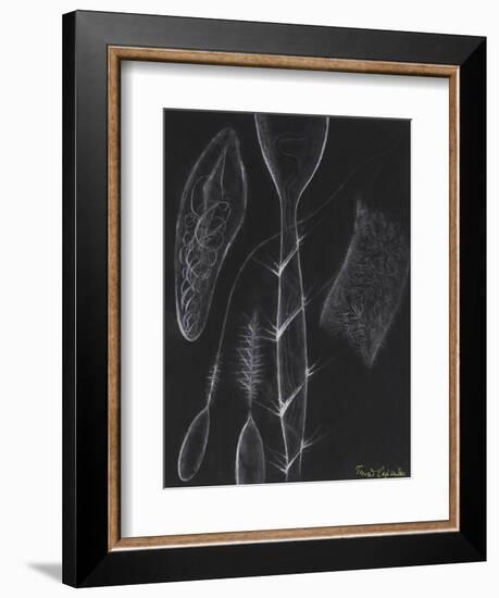 Anemone Stinging Cells-Philip Henry Gosse-Framed Giclee Print