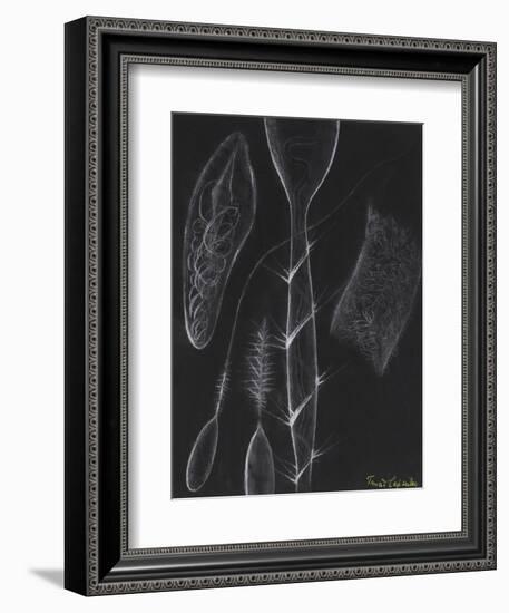 Anemone Stinging Cells-Philip Henry Gosse-Framed Giclee Print