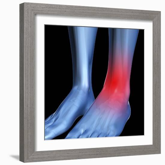 Ankle Pain, Conceptual Artwork-David Mack-Framed Premium Photographic Print