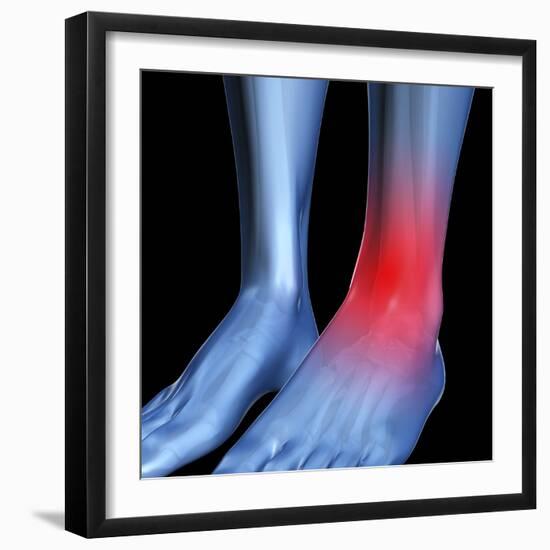 Ankle Pain, Conceptual Artwork-David Mack-Framed Premium Photographic Print