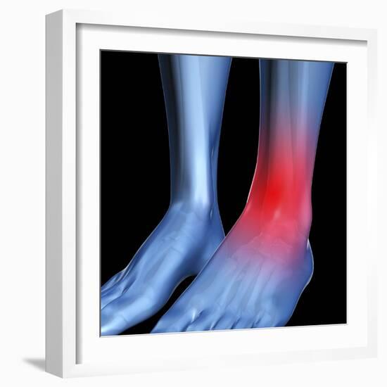 Ankle Pain, Conceptual Artwork-David Mack-Framed Premium Photographic Print