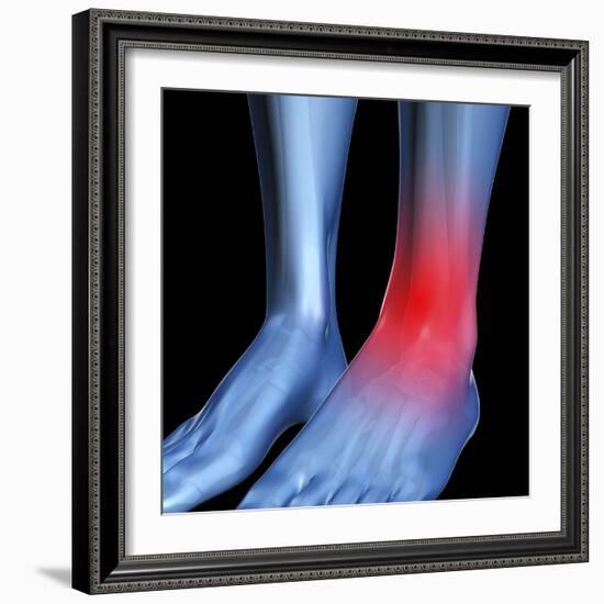 Ankle Pain, Conceptual Artwork-David Mack-Framed Premium Photographic Print