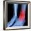 Ankle Pain, Conceptual Artwork-David Mack-Framed Photographic Print