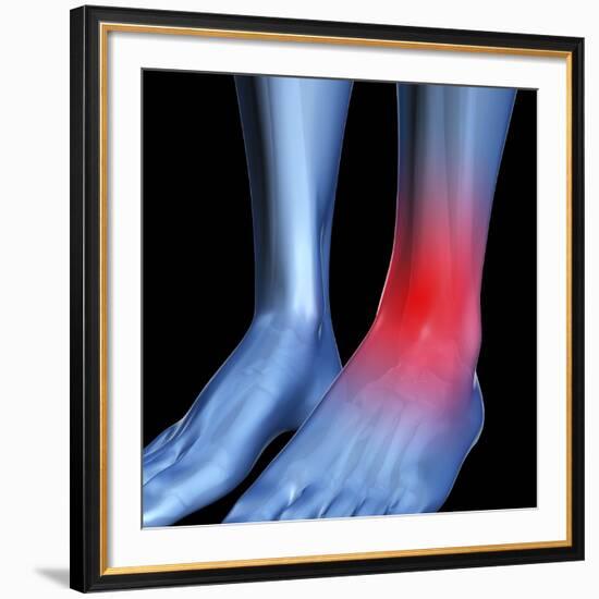 Ankle Pain, Conceptual Artwork-David Mack-Framed Photographic Print